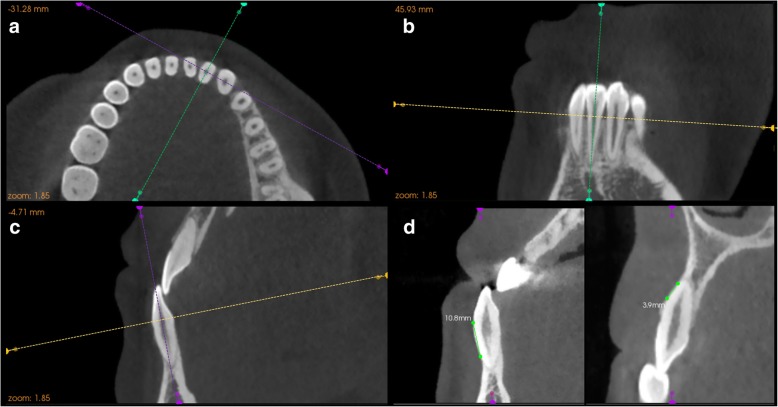 Fig. 3