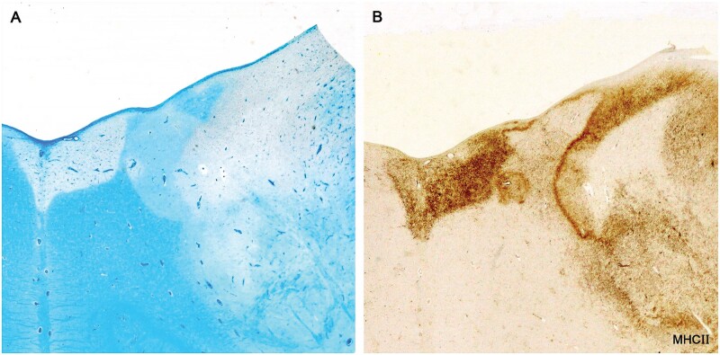 Figure 16.