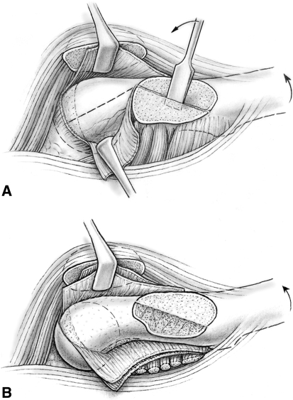 Fig. 2A–B