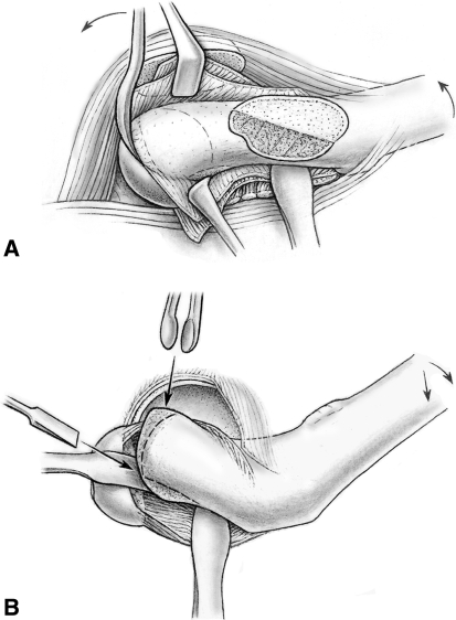 Fig. 3A–B