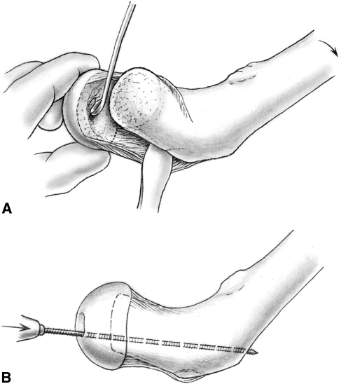 Fig. 4A–B