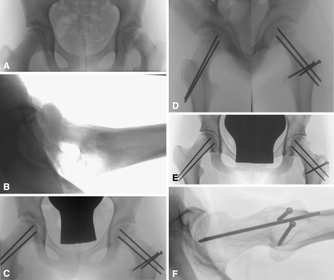 Fig. 6A–F