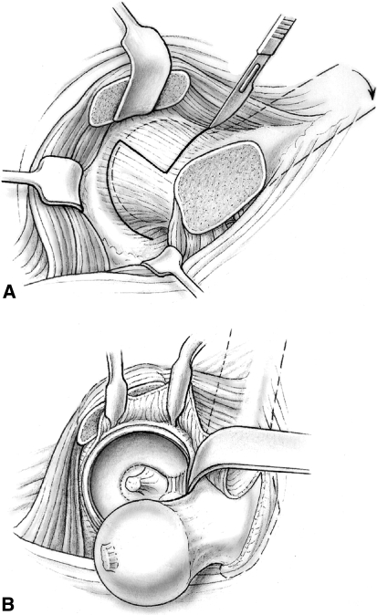 Fig. 1A–B