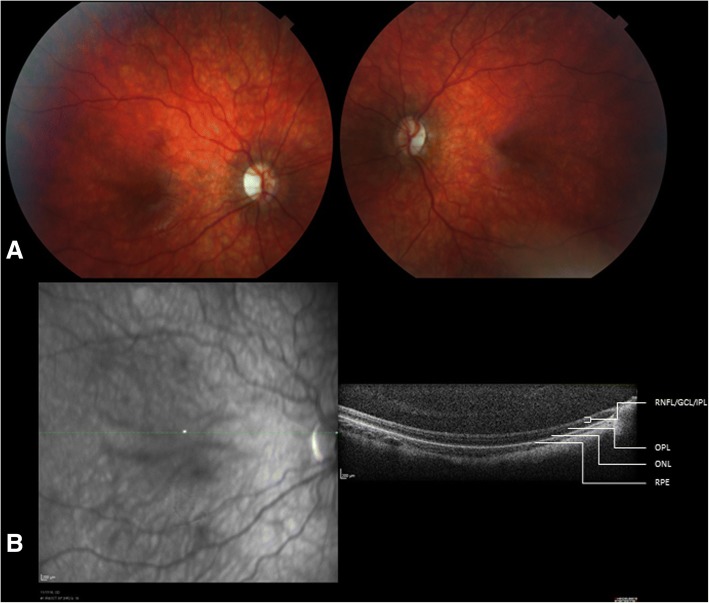 Fig. 1