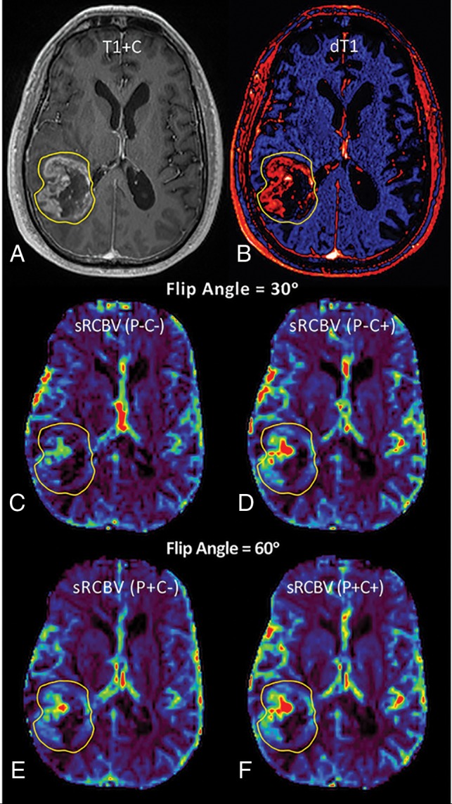 Fig 2.