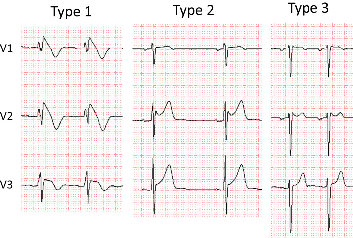 Fig. 1