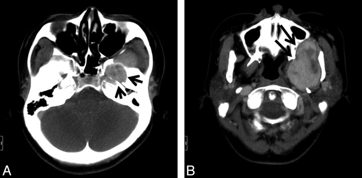 Fig 1.