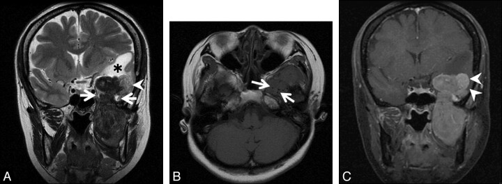 Fig 2.