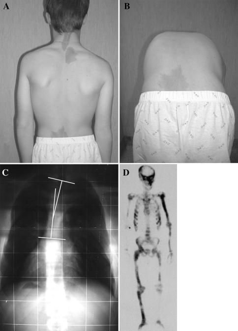 Fig. 1