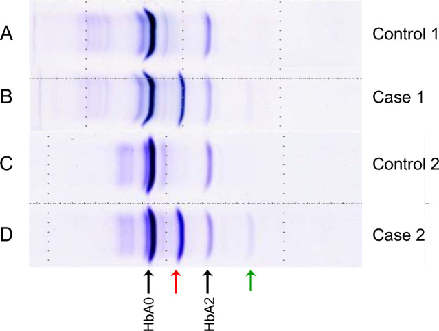 Fig. 2