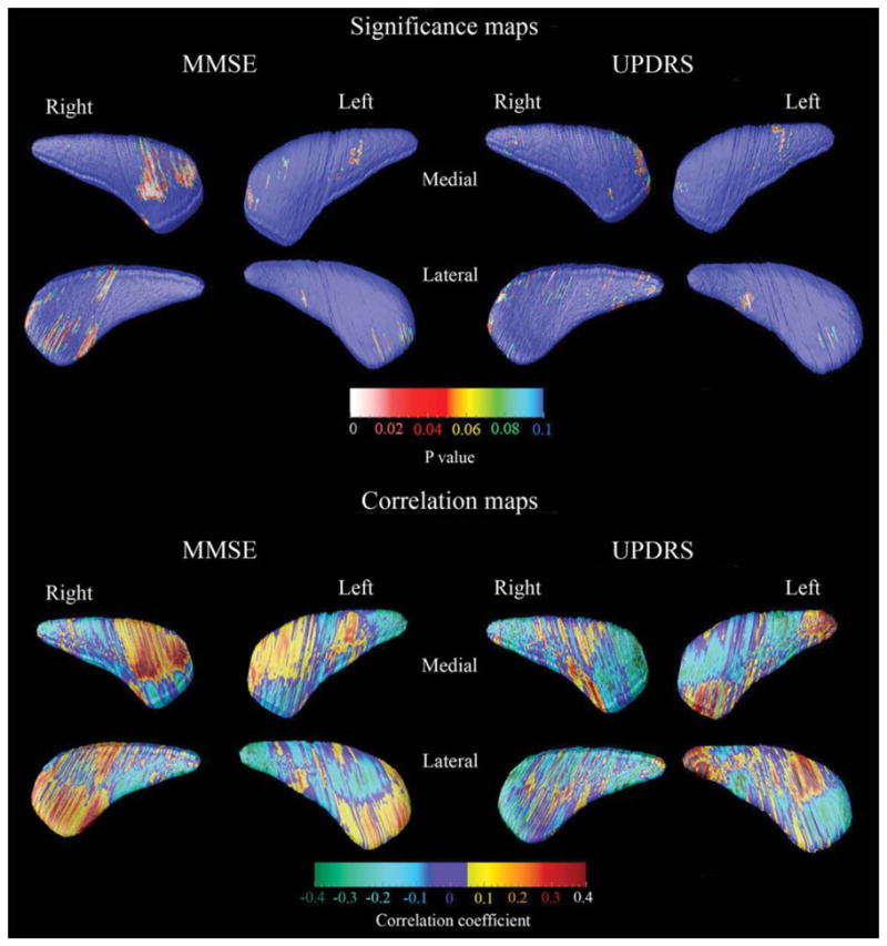 FIG. 3