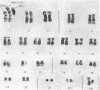 256