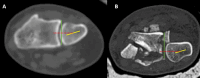 Fig. 15