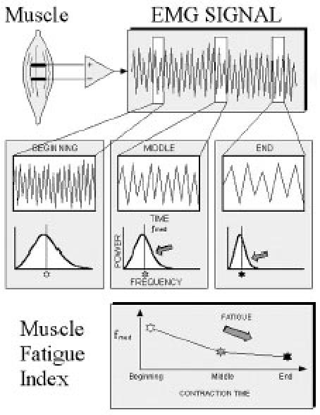 Fig. 11