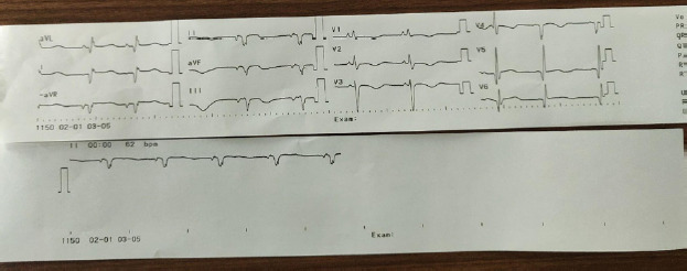 Figure 4B