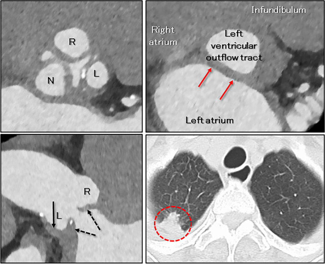 Figure 4.