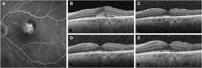 FIGURE 1