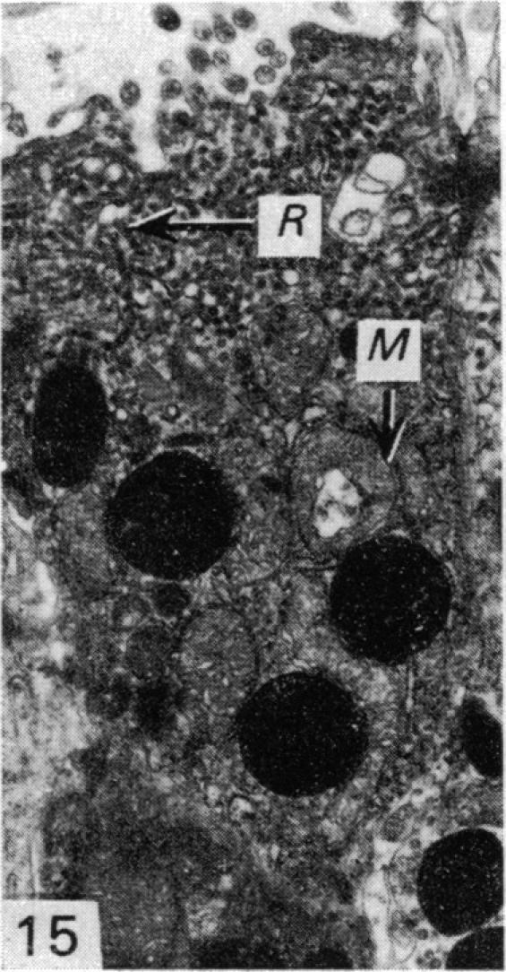 Fig. 15