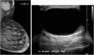 Fig. 12