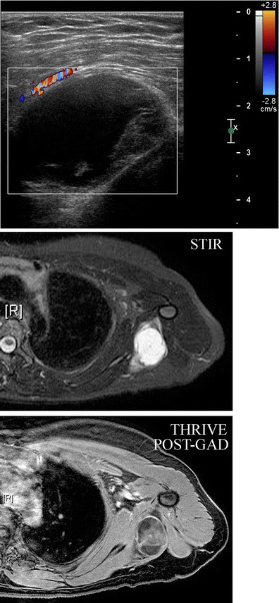 Fig. 15