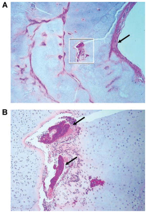 FIG. 6