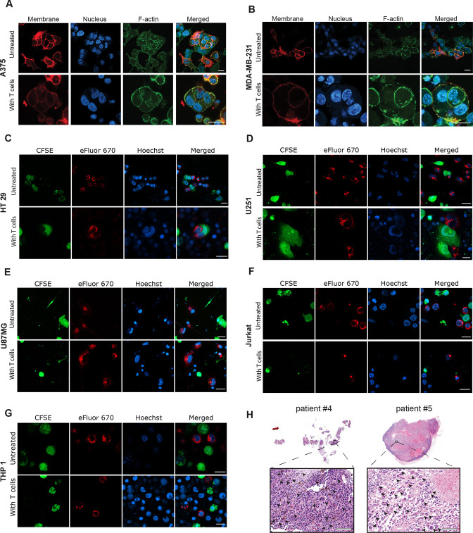 Figure 3—figure supplement 2.