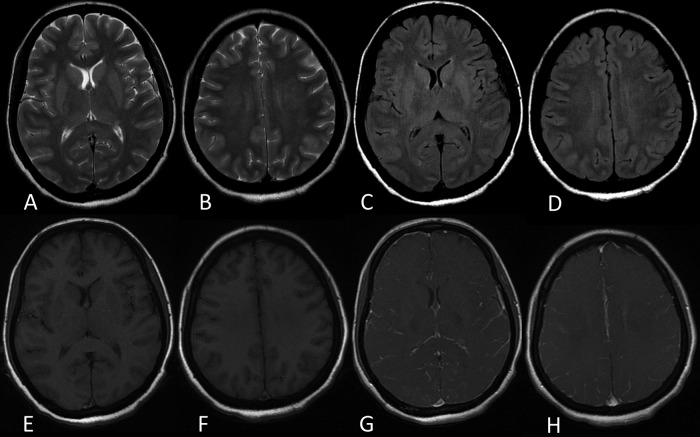 Figure 2