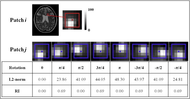 Fig. 1