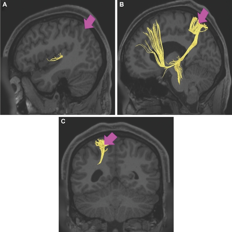 FIGURE 54.