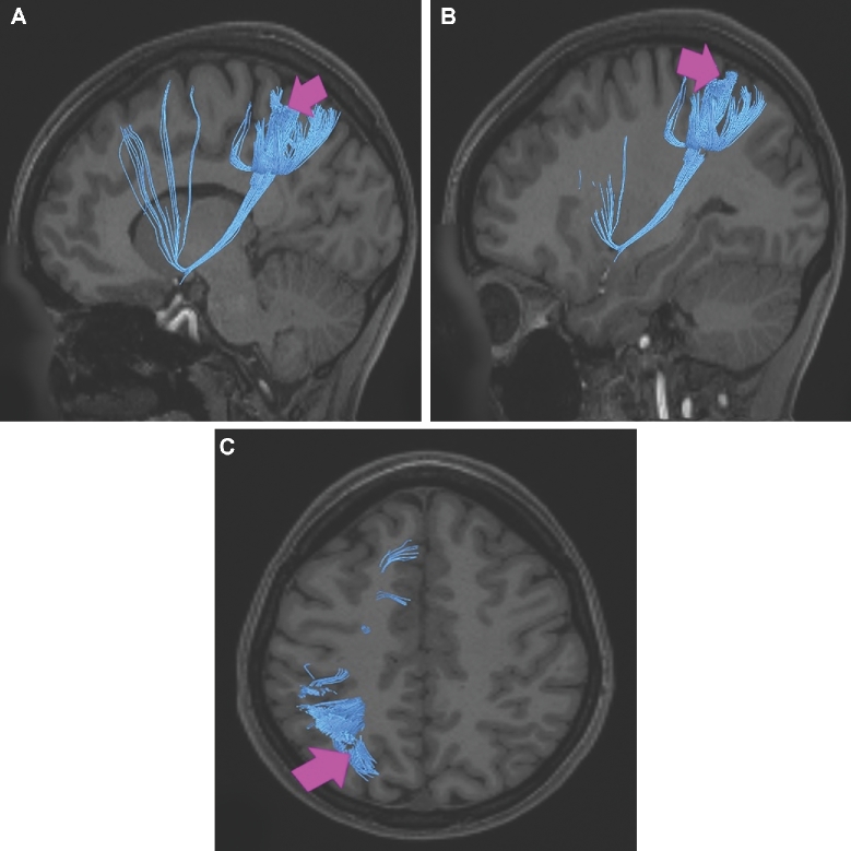 FIGURE 44.