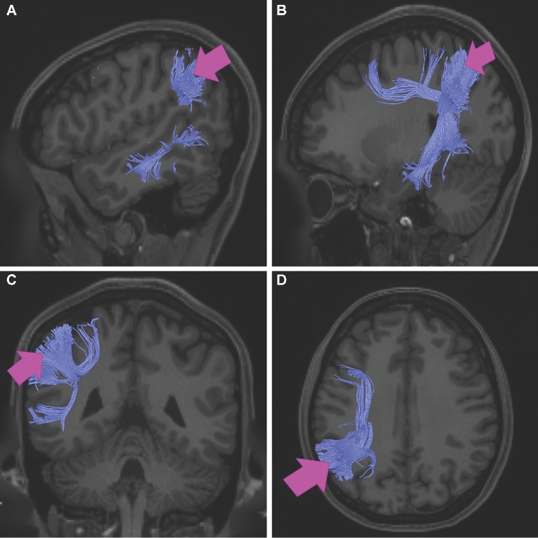 FIGURE 10.