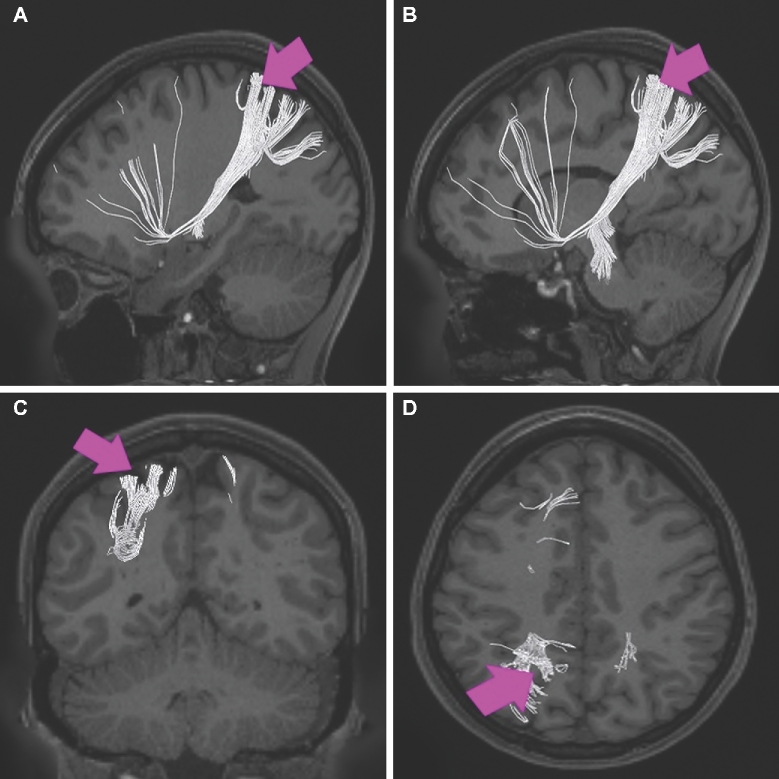 FIGURE 46.