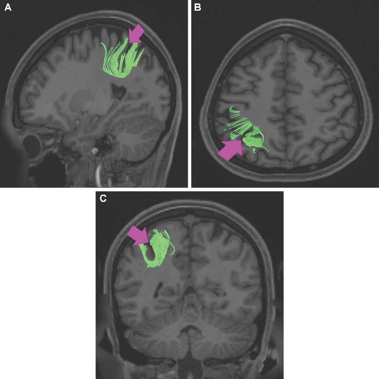 FIGURE 38.