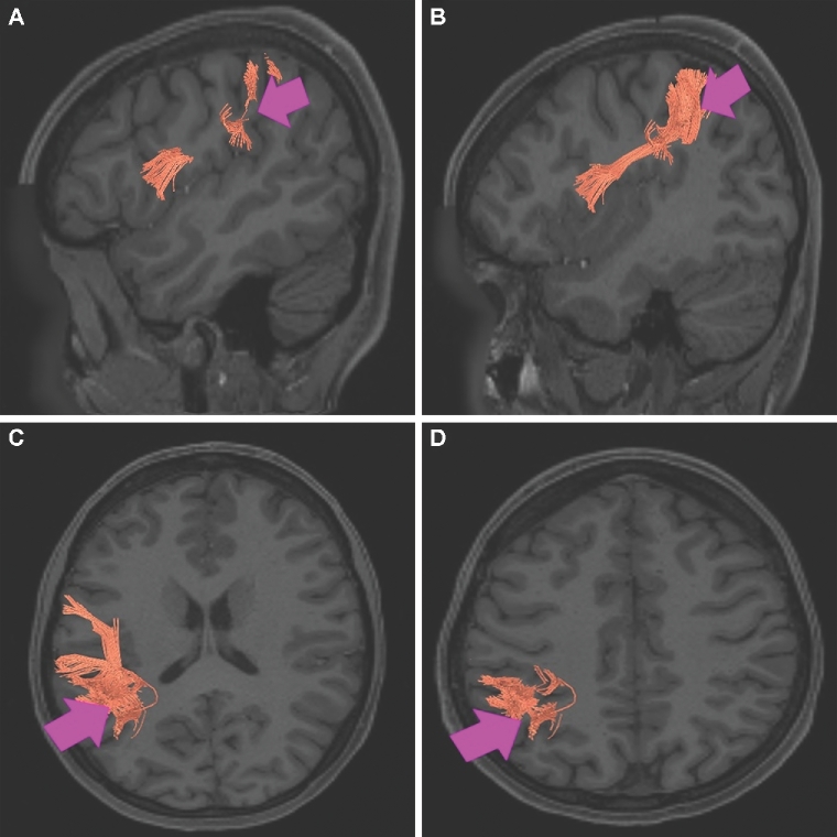 FIGURE 34.