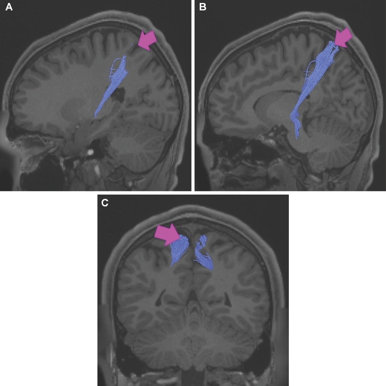 FIGURE 48.