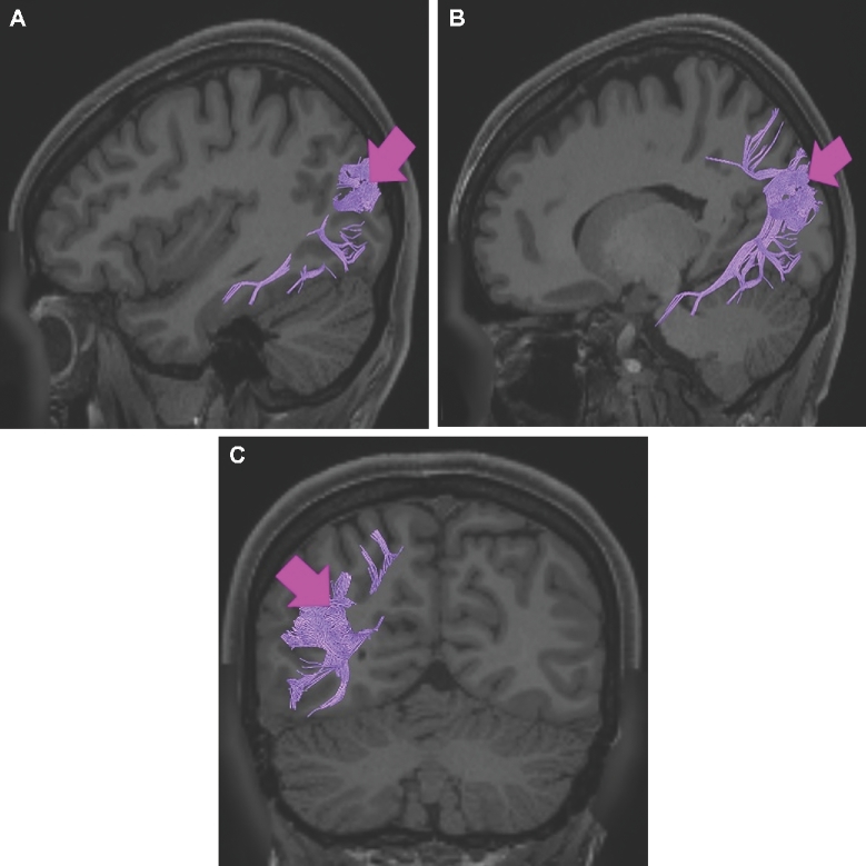 FIGURE 16.