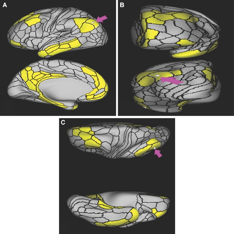 FIGURE 11.