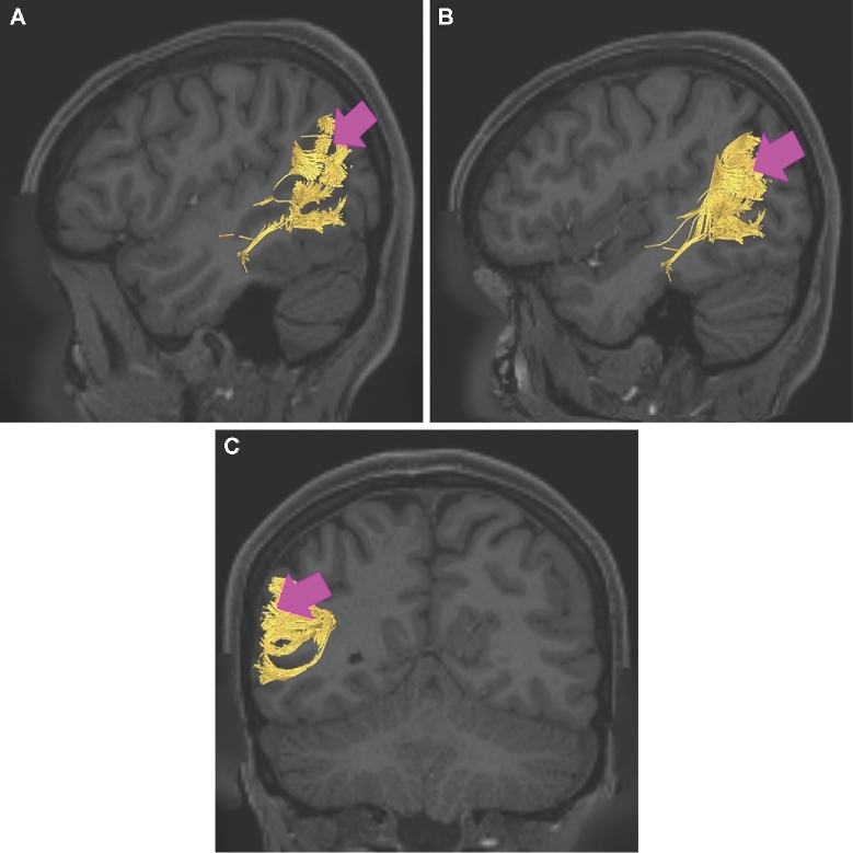 FIGURE 14.