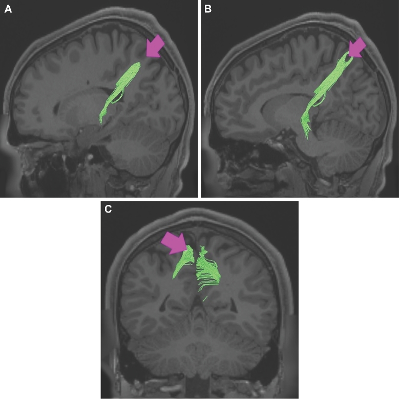 FIGURE 52.