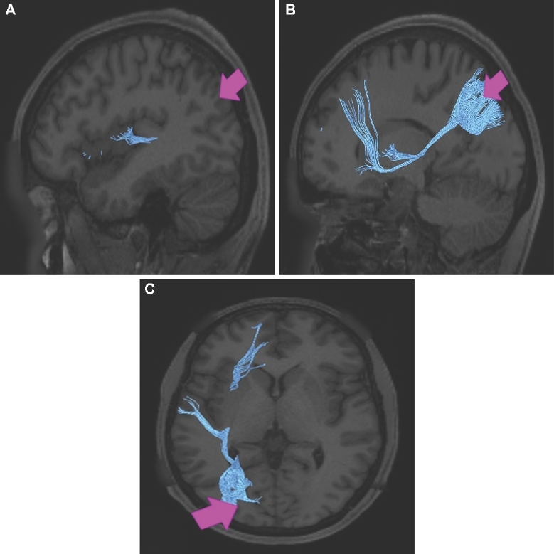 FIGURE 32.