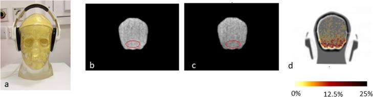 Fig. 10