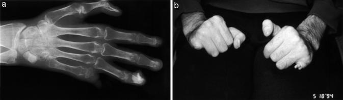 Figure 1a and b.