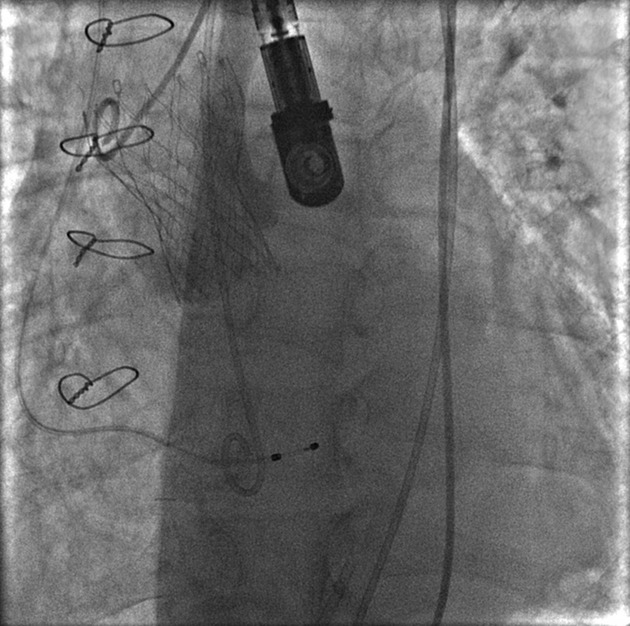 Figure 6