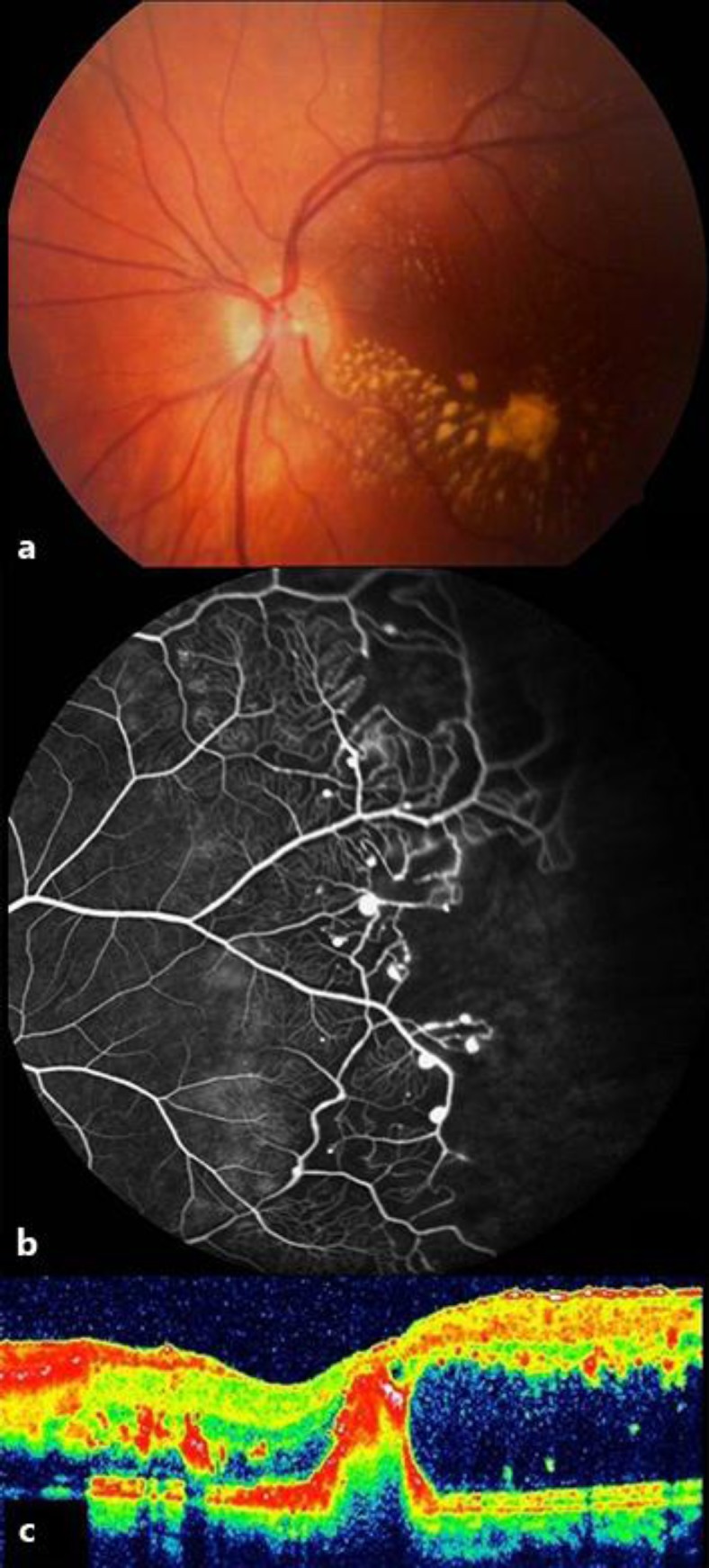 Fig. 3