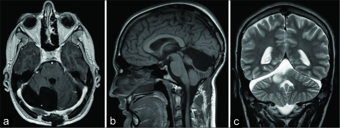 Figure 4: