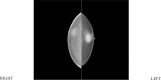 Figure 2A