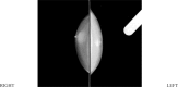 Figure 1A