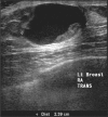 Figure 3B