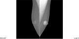 Figure 2B