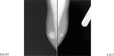 Figure 1B